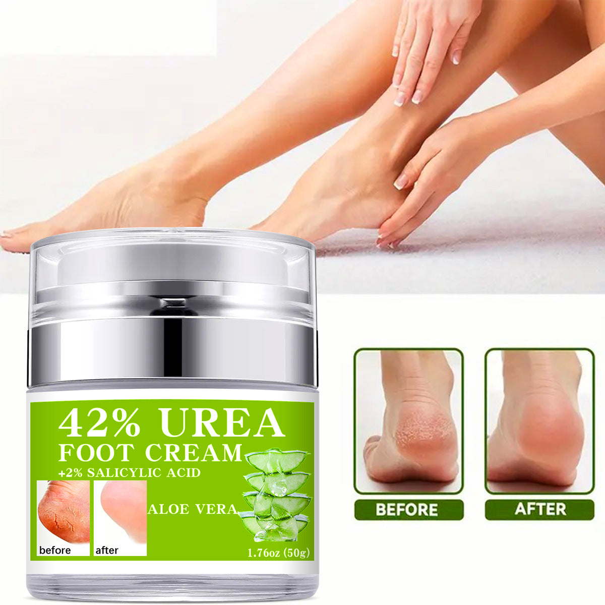 42% Urea Hand and Foot Cream for Dry and Cracked Skin: Moisturizing, Hydrating, and Nourishing Body Lotion, 50ml eprolo